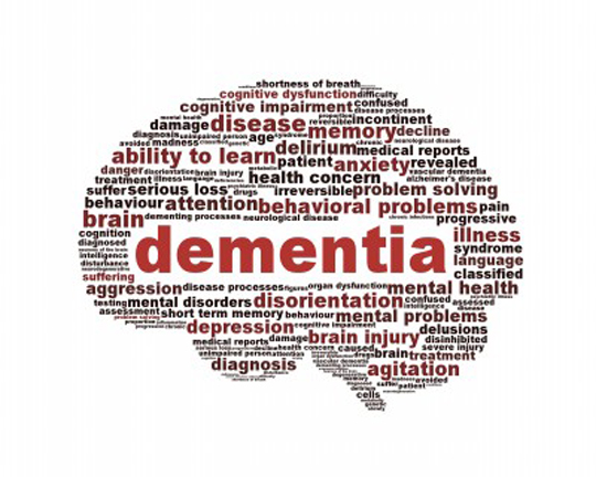 Risk Factors for Dementia