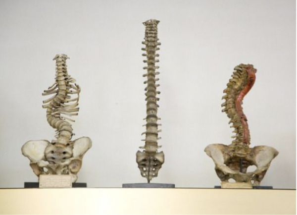 What is Modern Chiropractic?