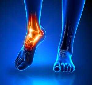 WHAT DO I DO ABOUT MY ANKLE PAIN?