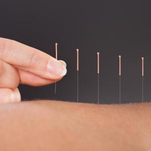 LESSENING PAIN WITH DRY NEEDLING