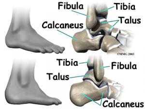 ANKLE IMPINGEMENT Complete Injury Guide